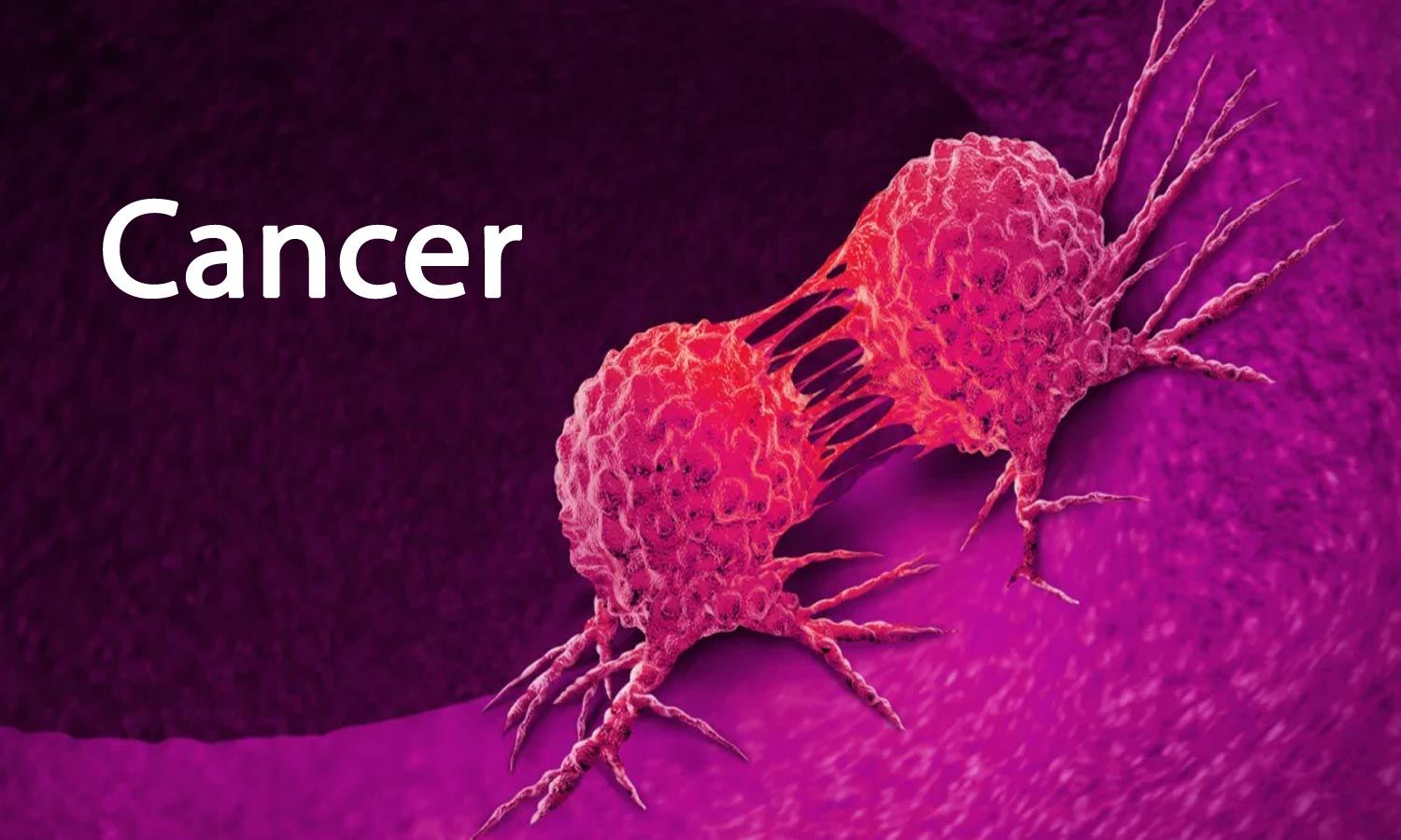 Cancer Patient Receiving Treatment